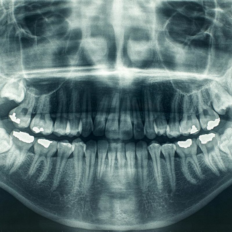 Panoramica dentale